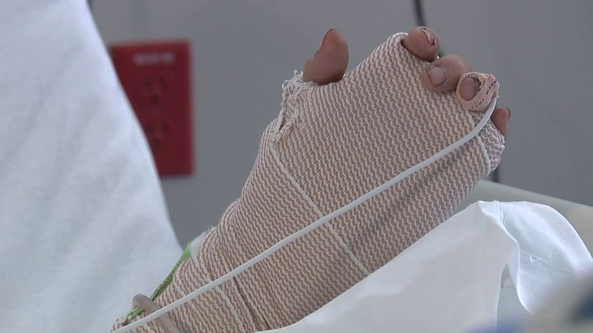 <a href="https://www.ksat.com/news/local/2025/04/25/this-cant-be-happening-from-a-san-antonio-hospital-woman-attacked-by-3-dogs-tells-her-story/" target="_blank">‘This can’t be happening’: From a San Antonio hospital, woman attacked by 3 dogs tells her story</a>