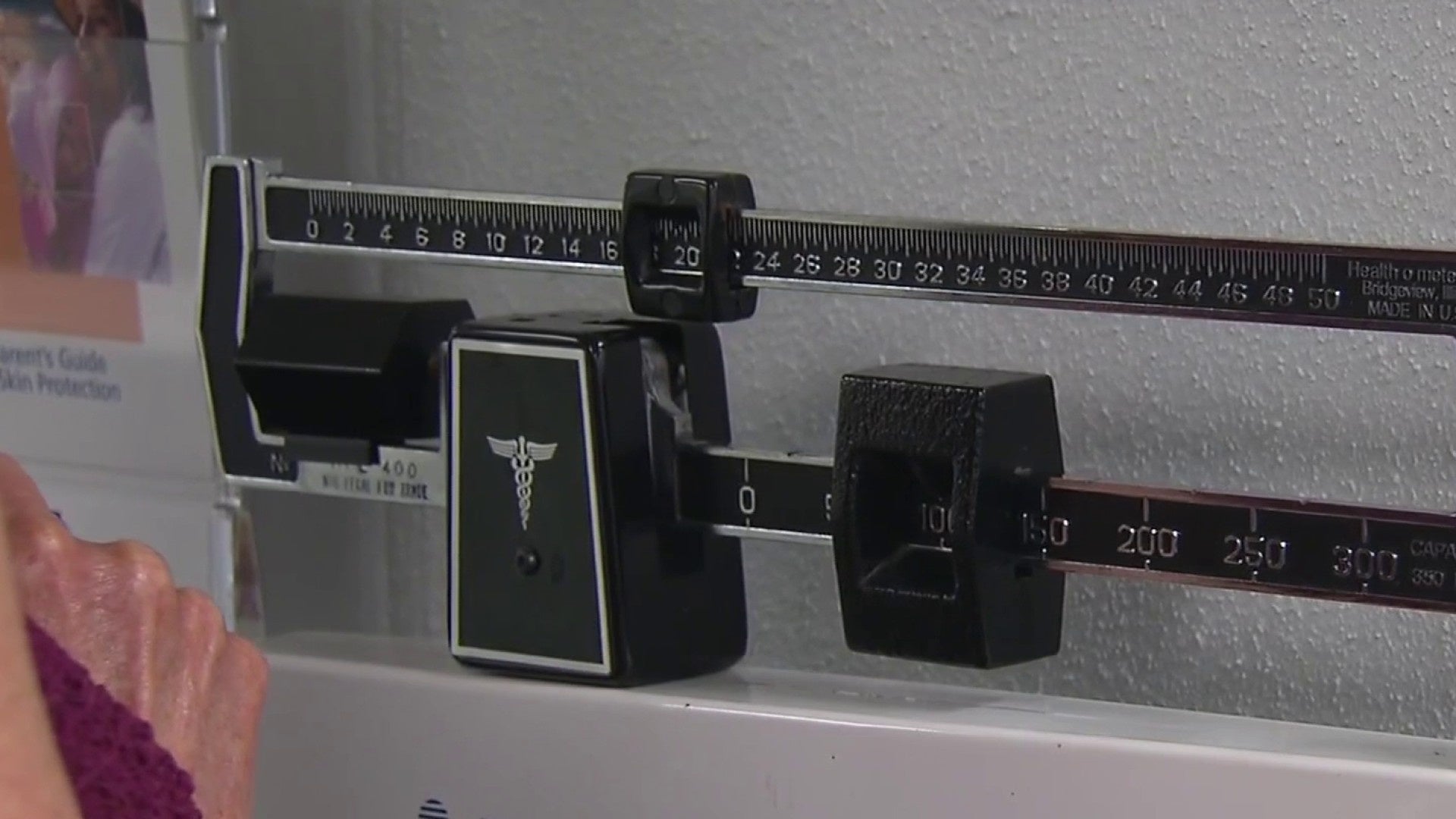 Stomach paralysis linked to weight loss drugs
